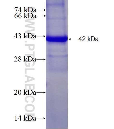 MYO9B fusion protein Ag28028 SDS-PAGE