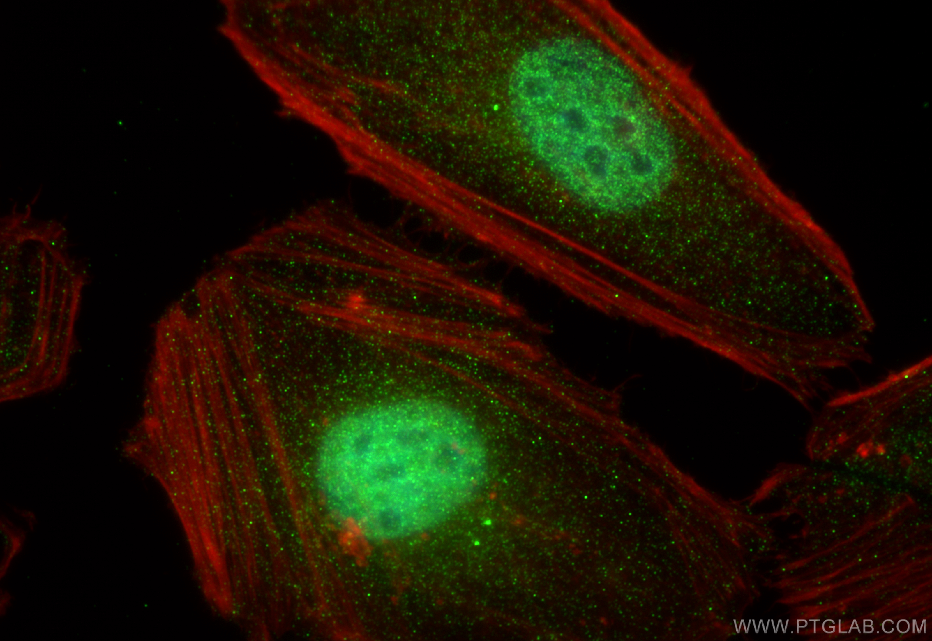 Immunofluorescence (IF) / fluorescent staining of HeLa cells using MYOD1 Polyclonal antibody (18943-1-AP)