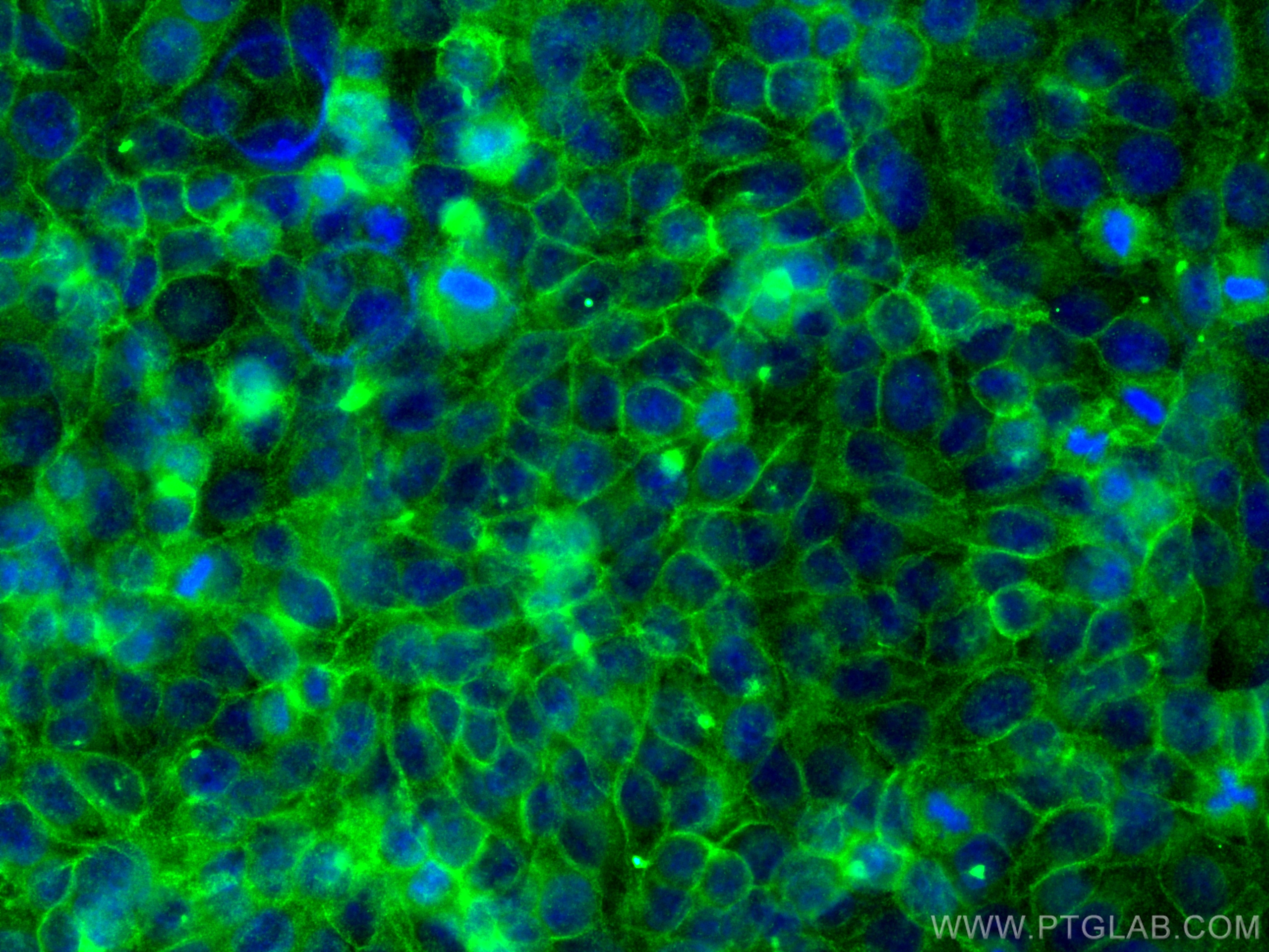 Immunofluorescence (IF) / fluorescent staining of HepG2 cells using MYOF Polyclonal antibody (19548-1-AP)