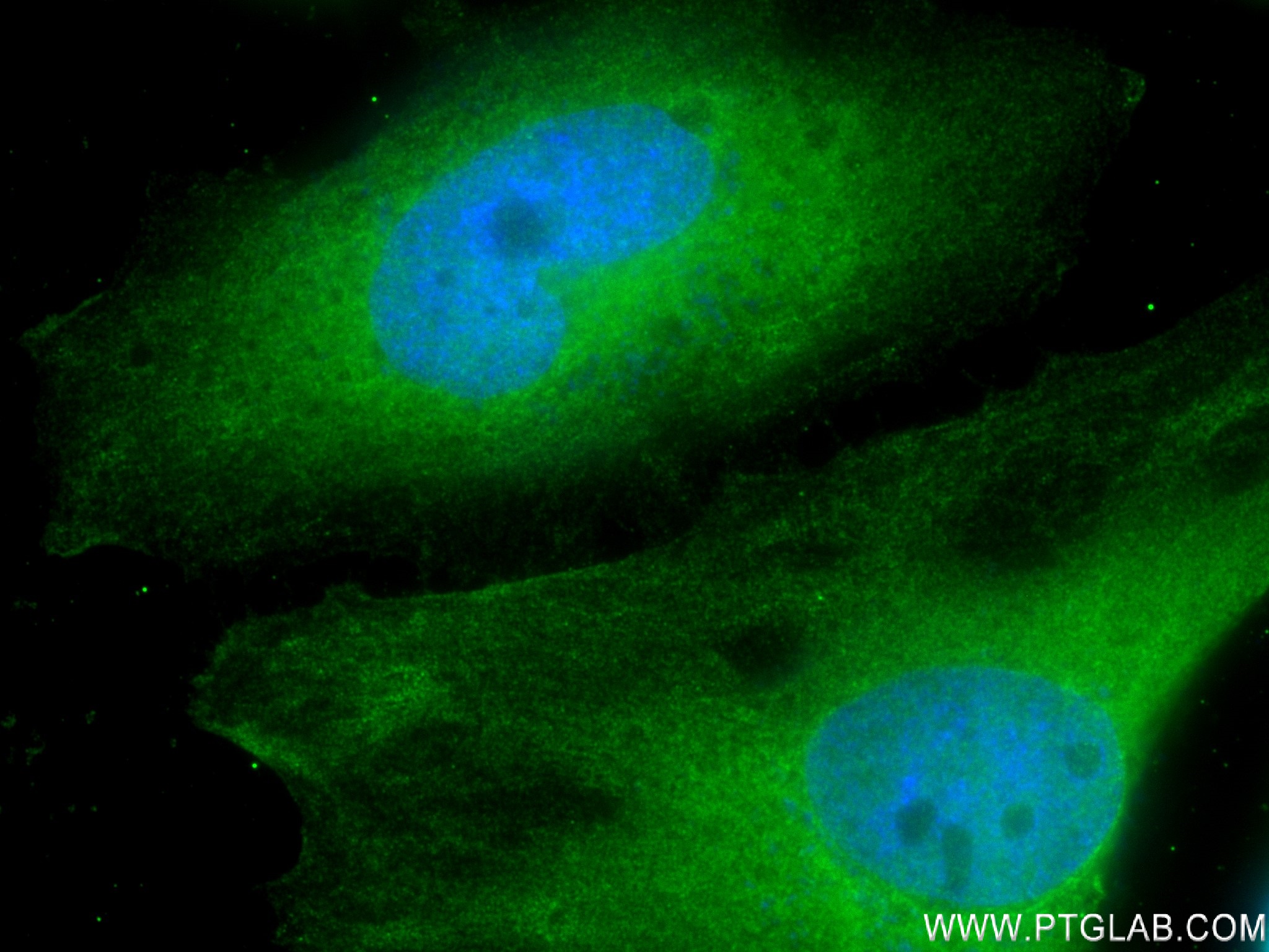 Immunofluorescence (IF) / fluorescent staining of HeLa cells using MYOF Recombinant antibody (82917-7-RR)