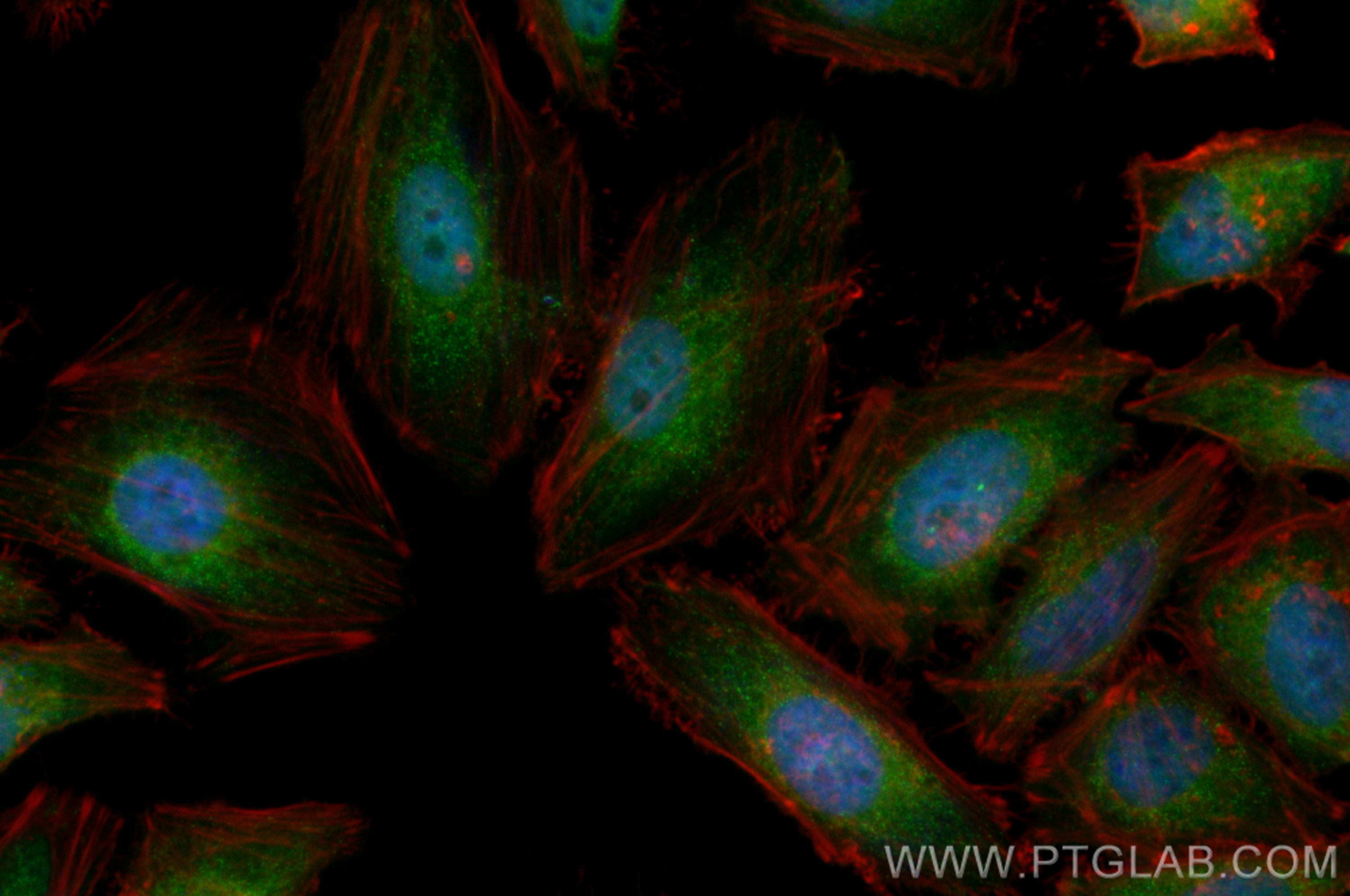 Immunofluorescence (IF) / fluorescent staining of HeLa cells using CoraLite® Plus 488-conjugated MYOF Recombinant ant (CL488-82917-7)