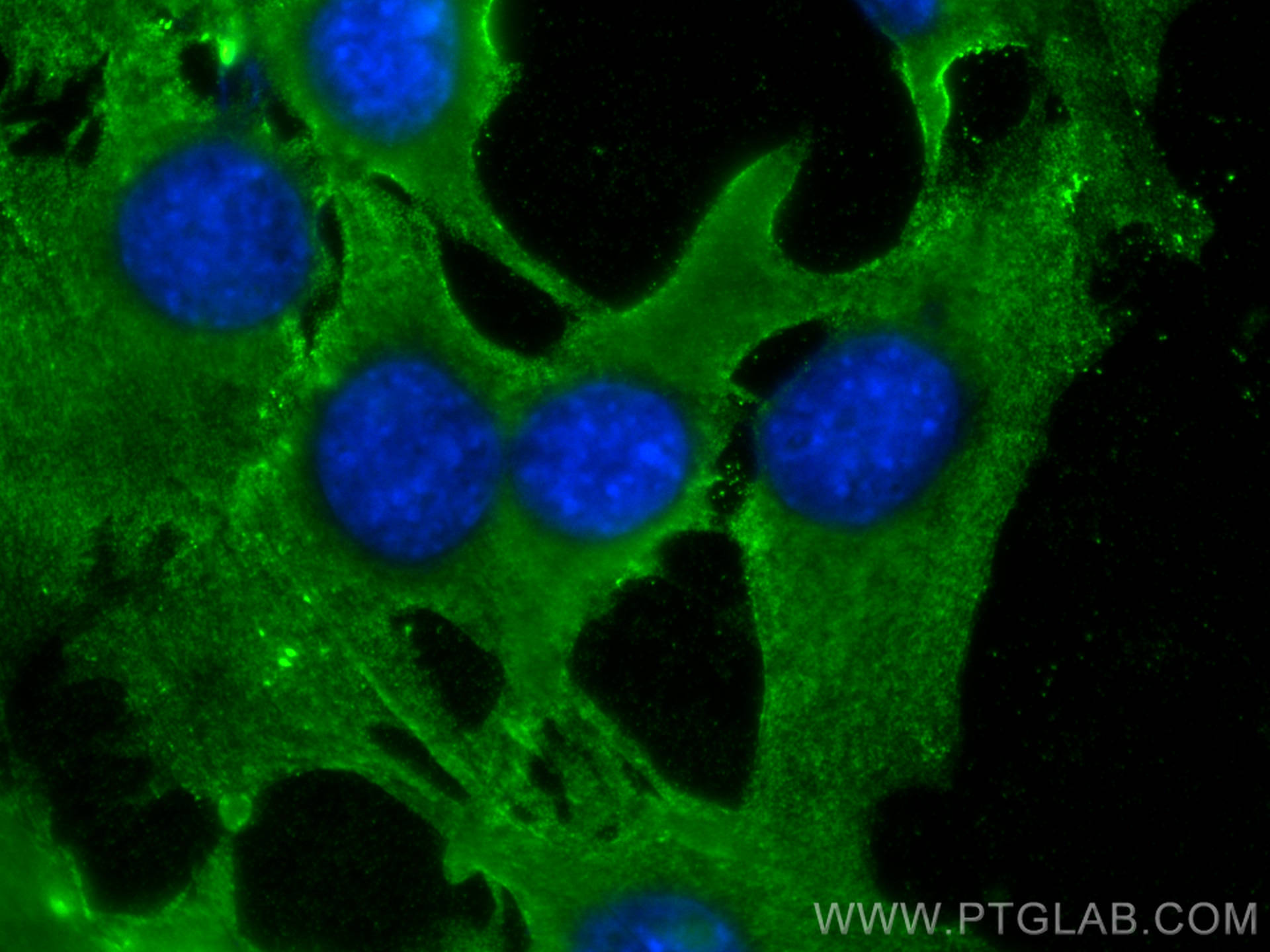 Immunofluorescence (IF) / fluorescent staining of C2C12 cells using MYOM1-Specific Polyclonal antibody (20360-1-AP)