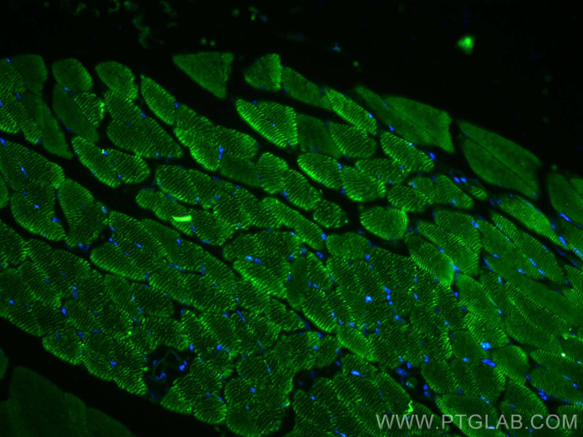 Immunofluorescence (IF) / fluorescent staining of mouse skeletal muscle tissue using MYOM3 Polyclonal antibody (17692-1-AP)