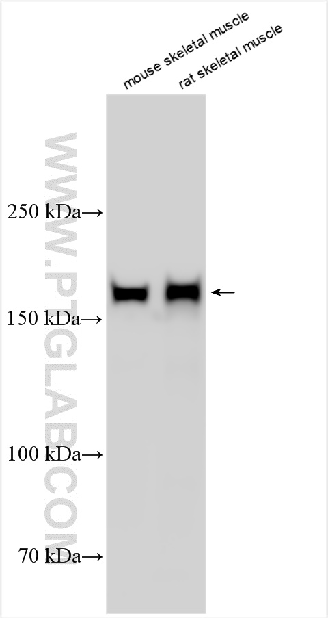 Western Blot (WB) analysis of various lysates using MYOM3 Polyclonal antibody (17692-1-AP)