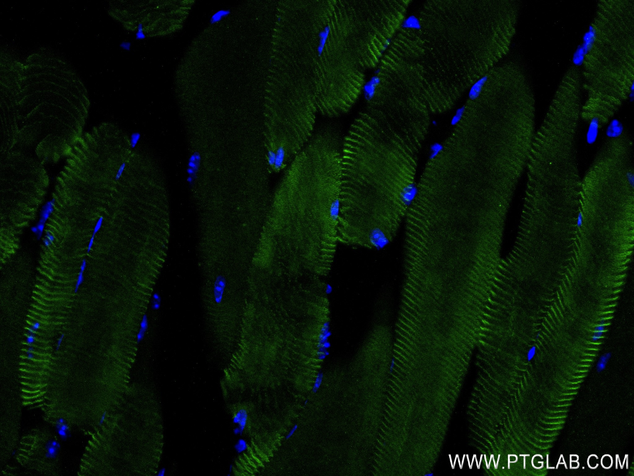 Immunofluorescence (IF) / fluorescent staining of mouse skeletal muscle tissue using MYOM3 Recombinant antibody (83852-3-RR)