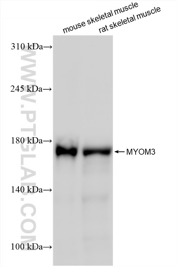 Western Blot (WB) analysis of various lysates using MYOM3 Recombinant antibody (83852-3-RR)