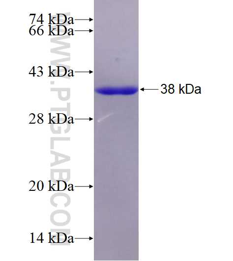 MYOZ2 fusion protein Ag28679 SDS-PAGE