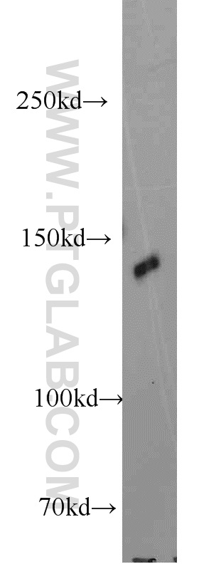 Western Blot (WB) analysis of HeLa cells using MYPN-Specific Polyclonal antibody (16180-1-AP)