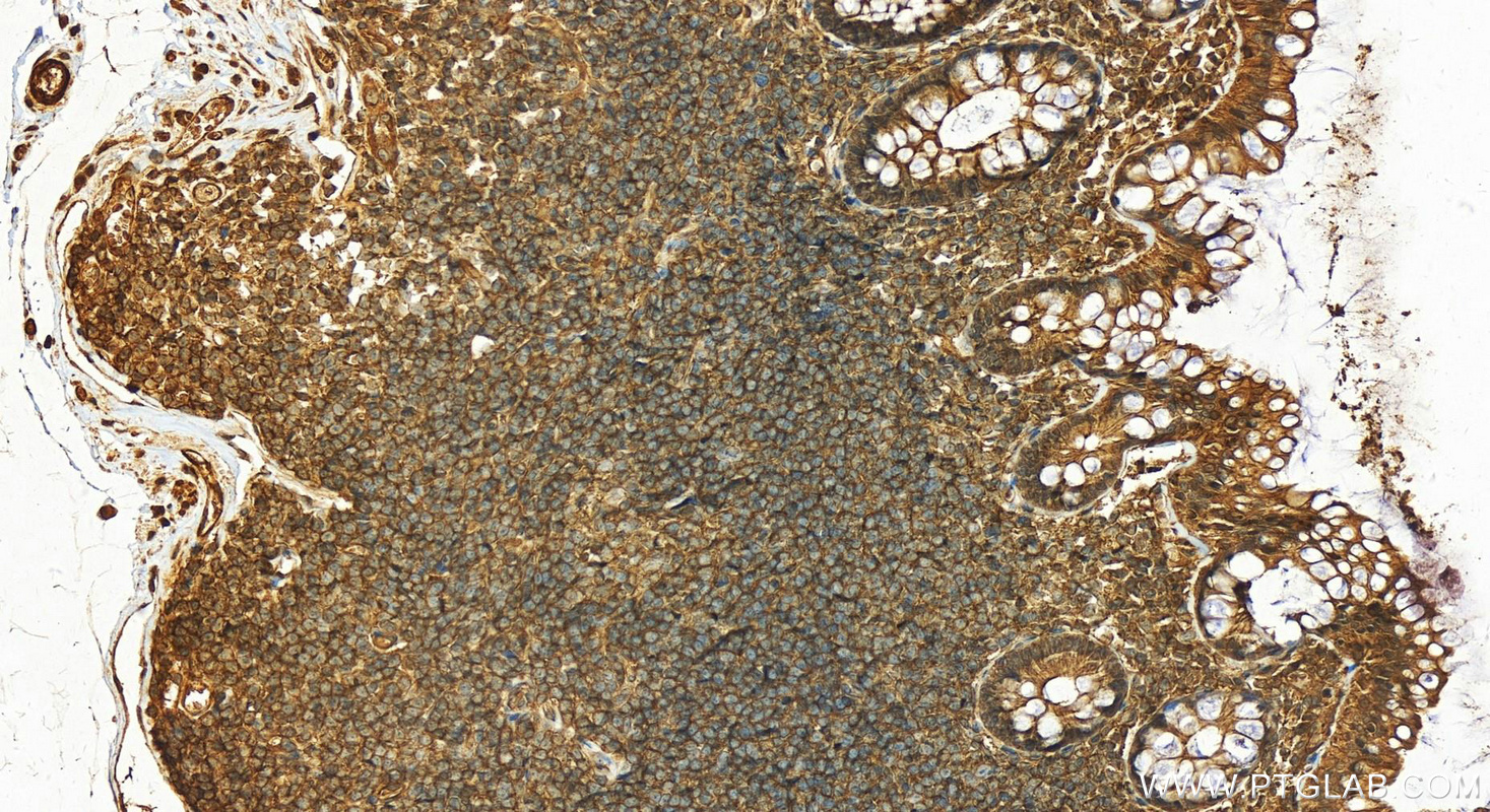 Immunohistochemistry (IHC) staining of human normal colon using MYPT1 Polyclonal antibody (22117-1-AP)