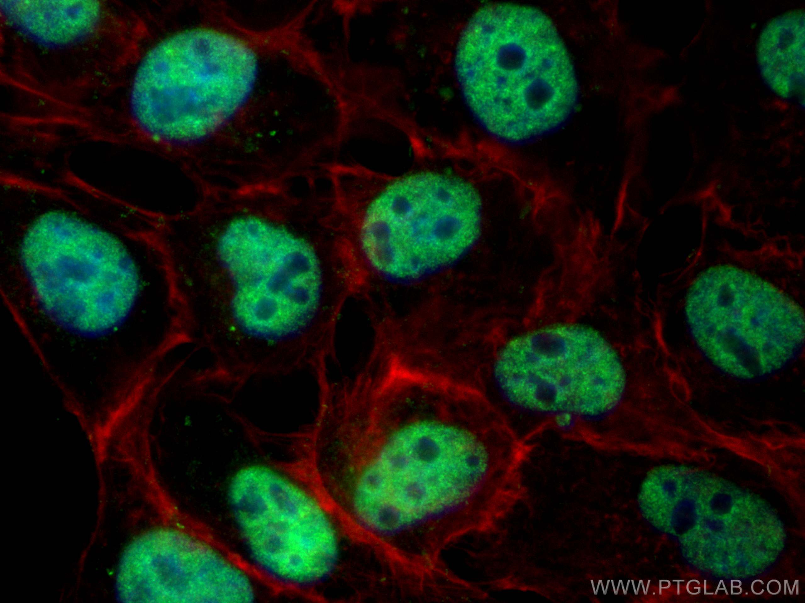 Immunofluorescence (IF) / fluorescent staining of A431 cells using MYSM1-Specific Polyclonal antibody (20078-1-AP)