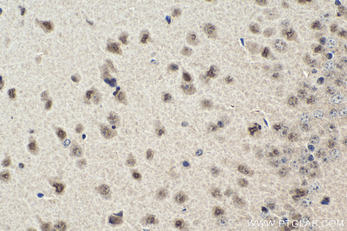 Immunohistochemistry (IHC) staining of mouse brain tissue using MYT1 Polyclonal antibody (26204-1-AP)