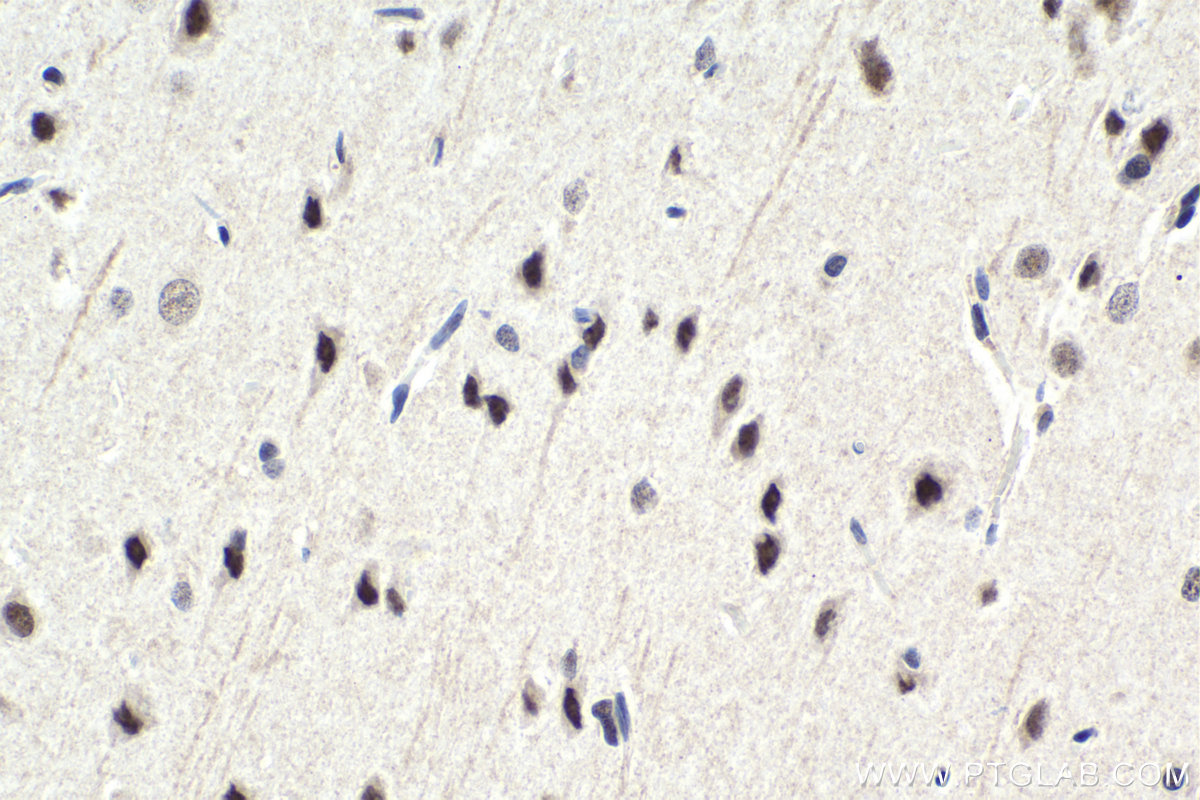 Immunohistochemistry (IHC) staining of rat brain tissue using MYT1 Polyclonal antibody (26204-1-AP)