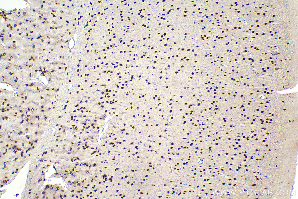 Immunohistochemistry (IHC) staining of mouse brain tissue using MYT1L Polyclonal antibody (25234-1-AP)