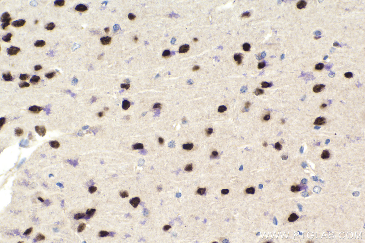 Immunohistochemistry (IHC) staining of mouse brain tissue using MYT1L Polyclonal antibody (25234-1-AP)