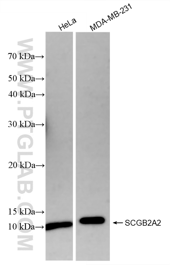Western Blot (WB) analysis of various lysates using Mammaglobin A Recombinant antibody (85657-5-RR)