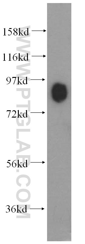 Western Blot (WB) analysis of mouse brain tissue using Marcks Polyclonal antibody (10004-2-Ig)