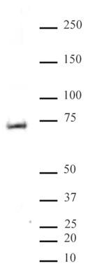 MeCP2 phospho Ser80 antibody (pAb) tested by Western blot. Detection of MeCP2 phospho Ser80 by Western blot analysis. Rat brain extract (20 ug) probed with MeCP2 phospho Ser80 antibody (pAb) at a 1:5,000 dilution.
