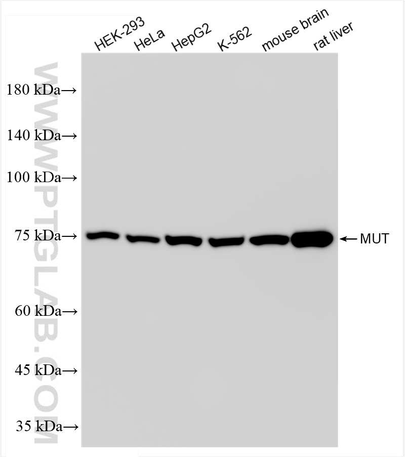 Western Blot (WB) analysis of various lysates using Methylmalonyl Coenzyme A mutase/MUT Recombinant an (84879-5-RR)