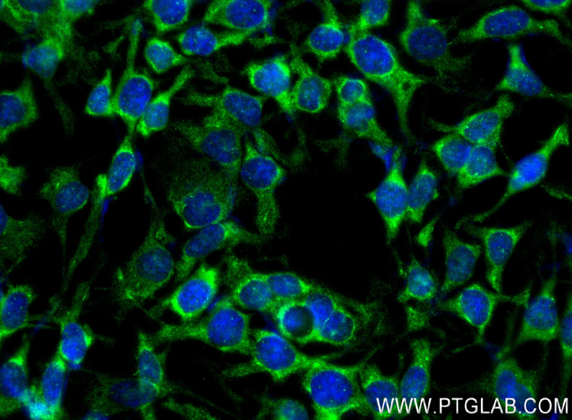 Immunofluorescence (IF) / fluorescent staining of HeLa cells using Midkine Recombinant antibody (84815-1-RR)