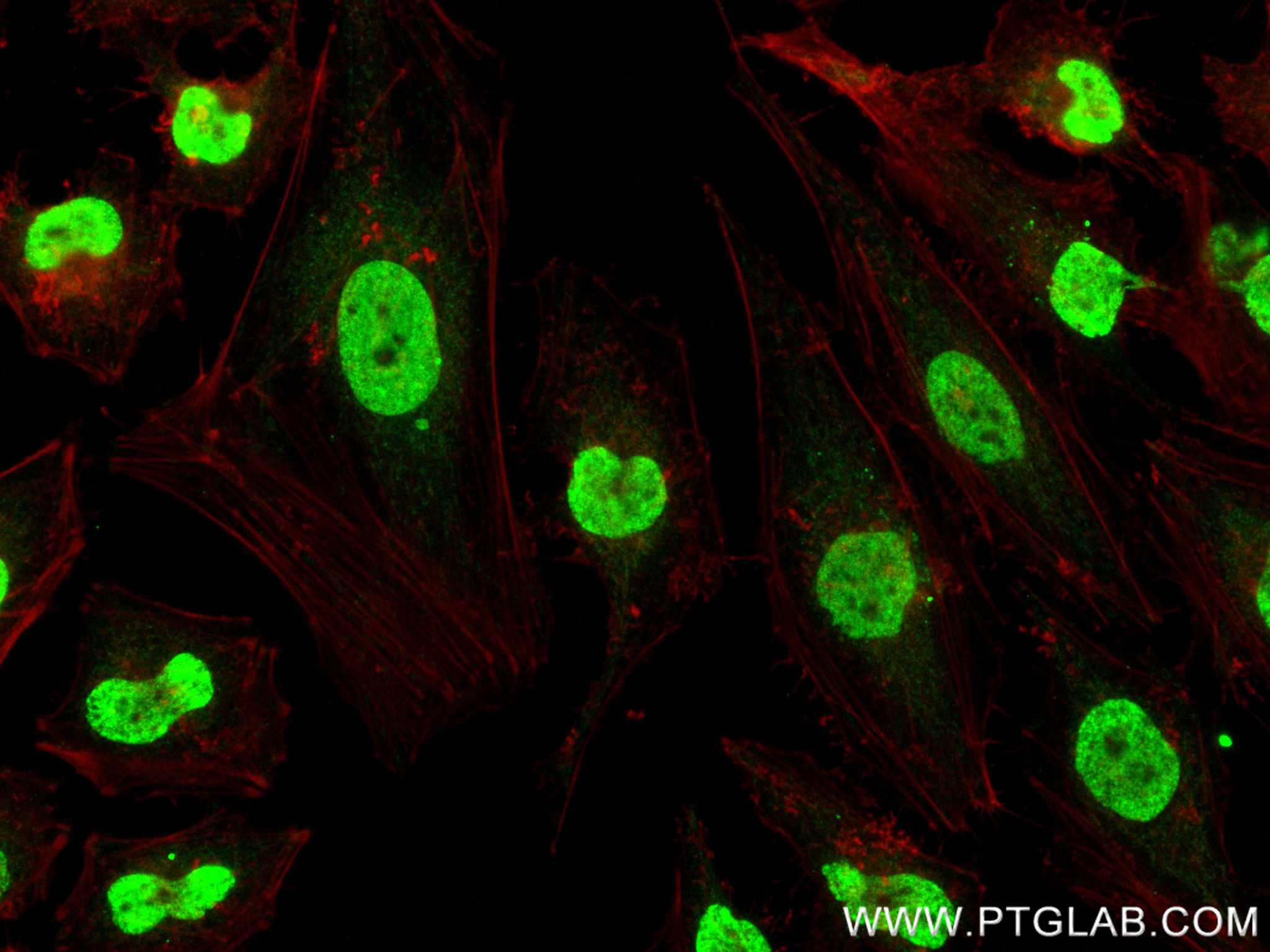 Immunofluorescence (IF) / fluorescent staining of HeLa cells using Mono/Di-Methyl-Histone H3 (Lys9) Recombinant antib (80219-1-RR)