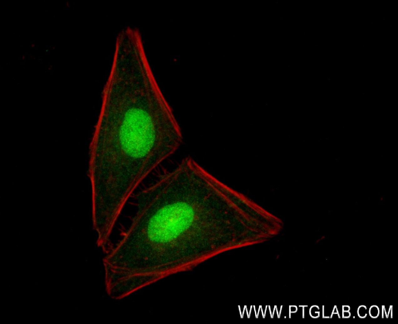 Immunofluorescence (IF) / fluorescent staining of HeLa cells using Mono-Methyl-Histone H3 (Lys36) Recombinant antibod (82825-2-RR)