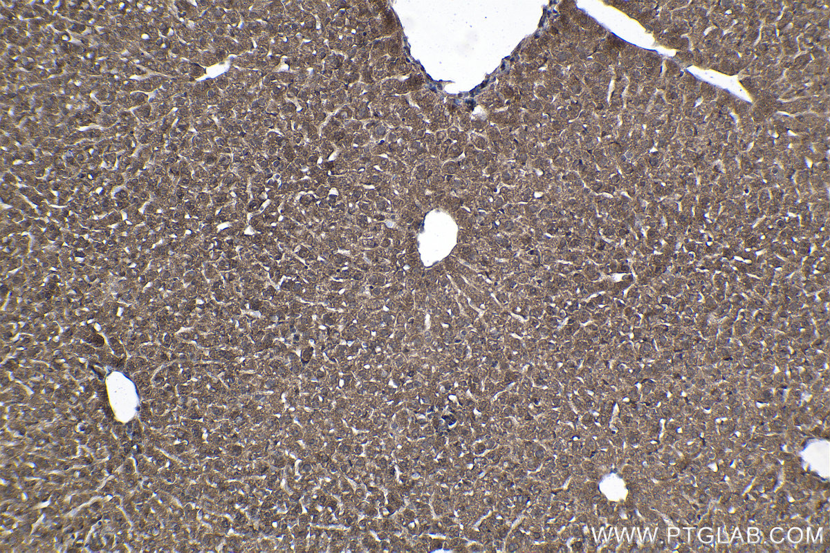 Immunohistochemistry (IHC) staining of mouse liver tissue using MSI2 Polyclonal antibody (10770-1-AP)