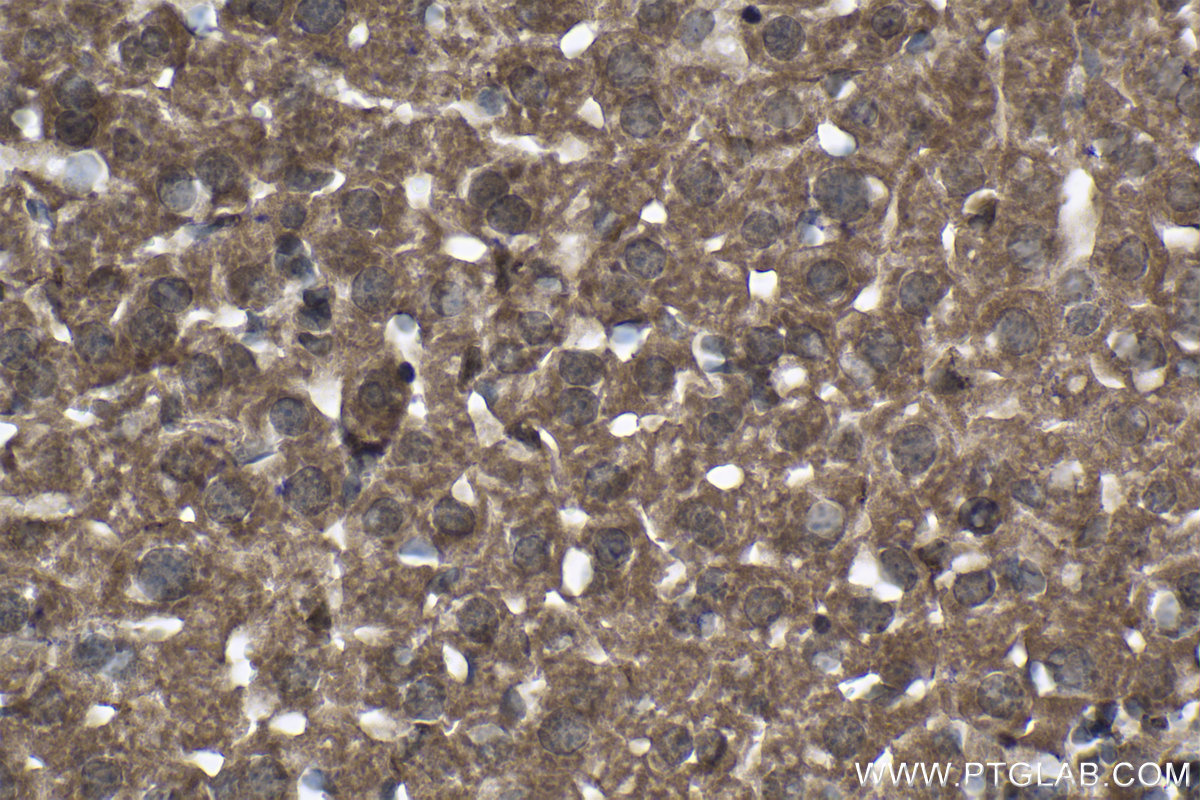 Immunohistochemistry (IHC) staining of mouse liver tissue using MSI2 Polyclonal antibody (10770-1-AP)