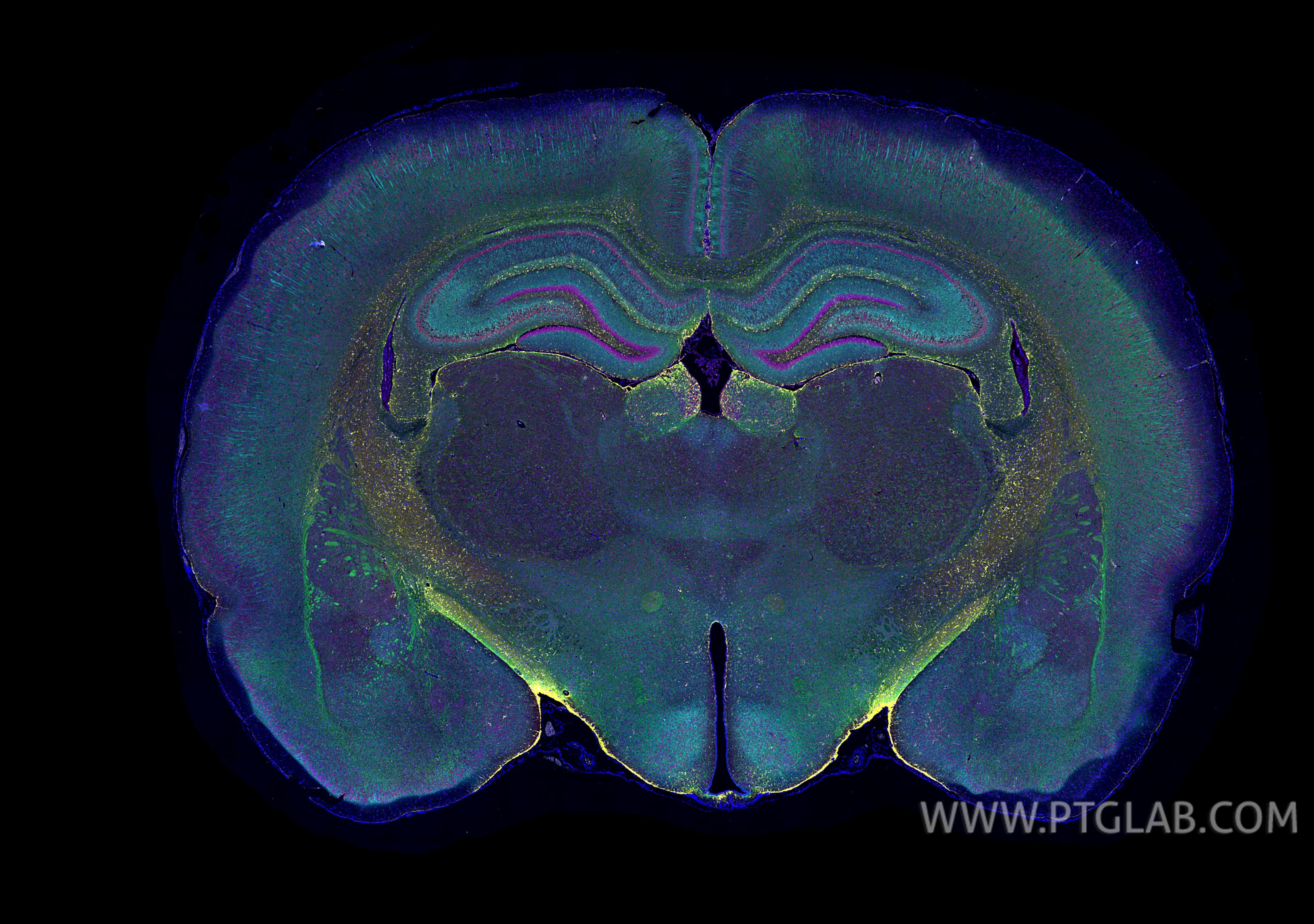 Immunofluorescence (IF) / fluorescent staining of rat brain tissue using CoraLite® Plus 488-conjugated MBP Polyclonal antib (CL488-10458)