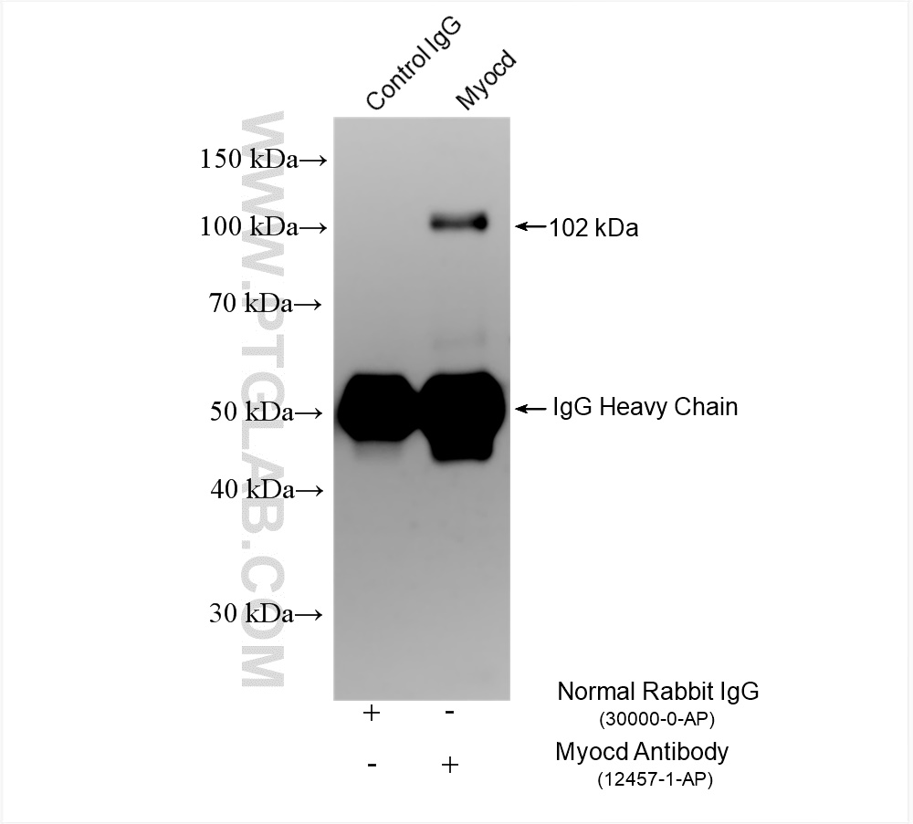 Immunoprecipitation (IP) experiment of HepG2 cells using Myocd Polyclonal antibody (12457-1-AP)