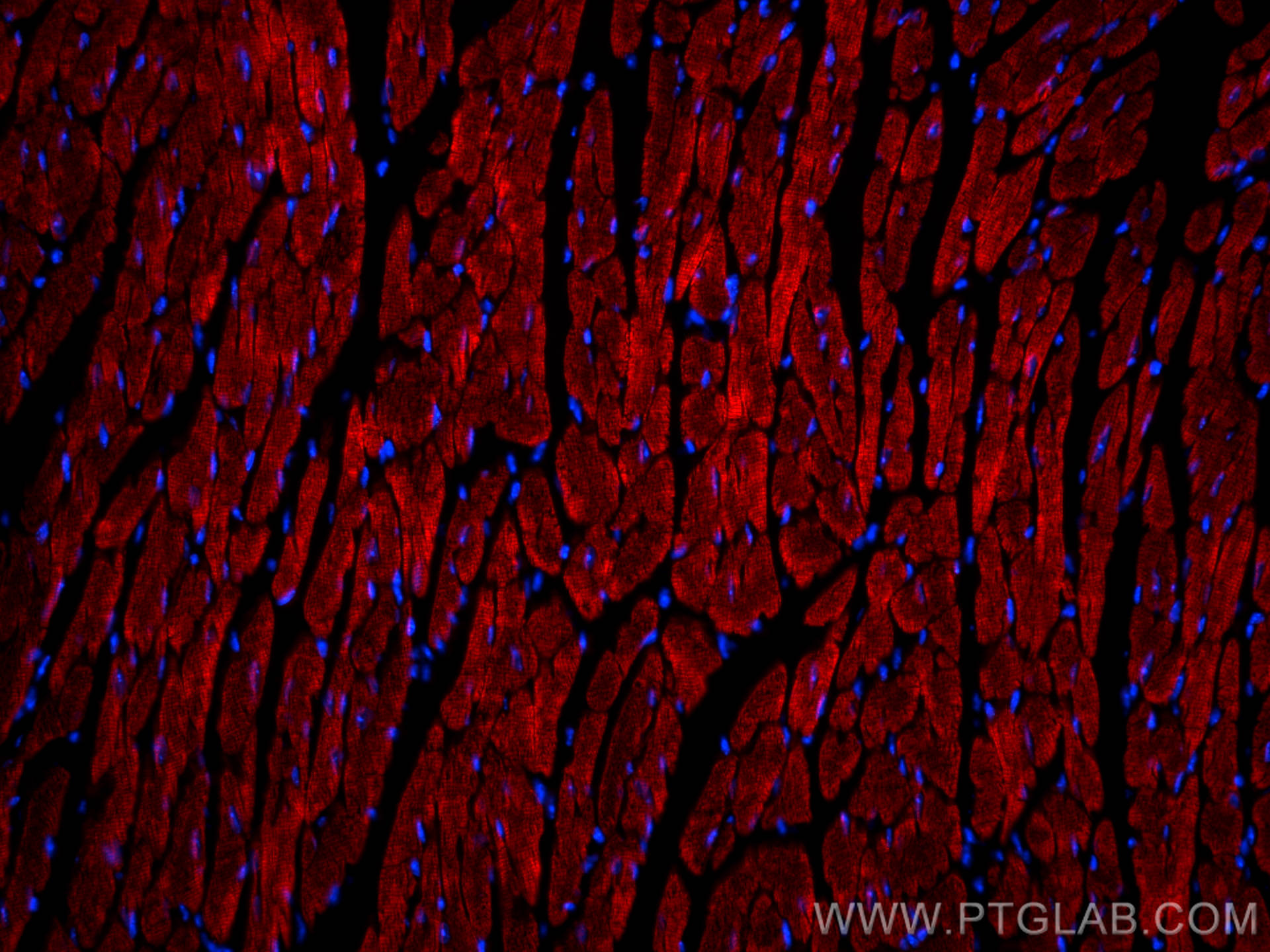 Immunofluorescence (IF) / fluorescent staining of mouse heart tissue using CoraLite®594-conjugated Myosin Light Chain 2 Monoc (CL594-60229)