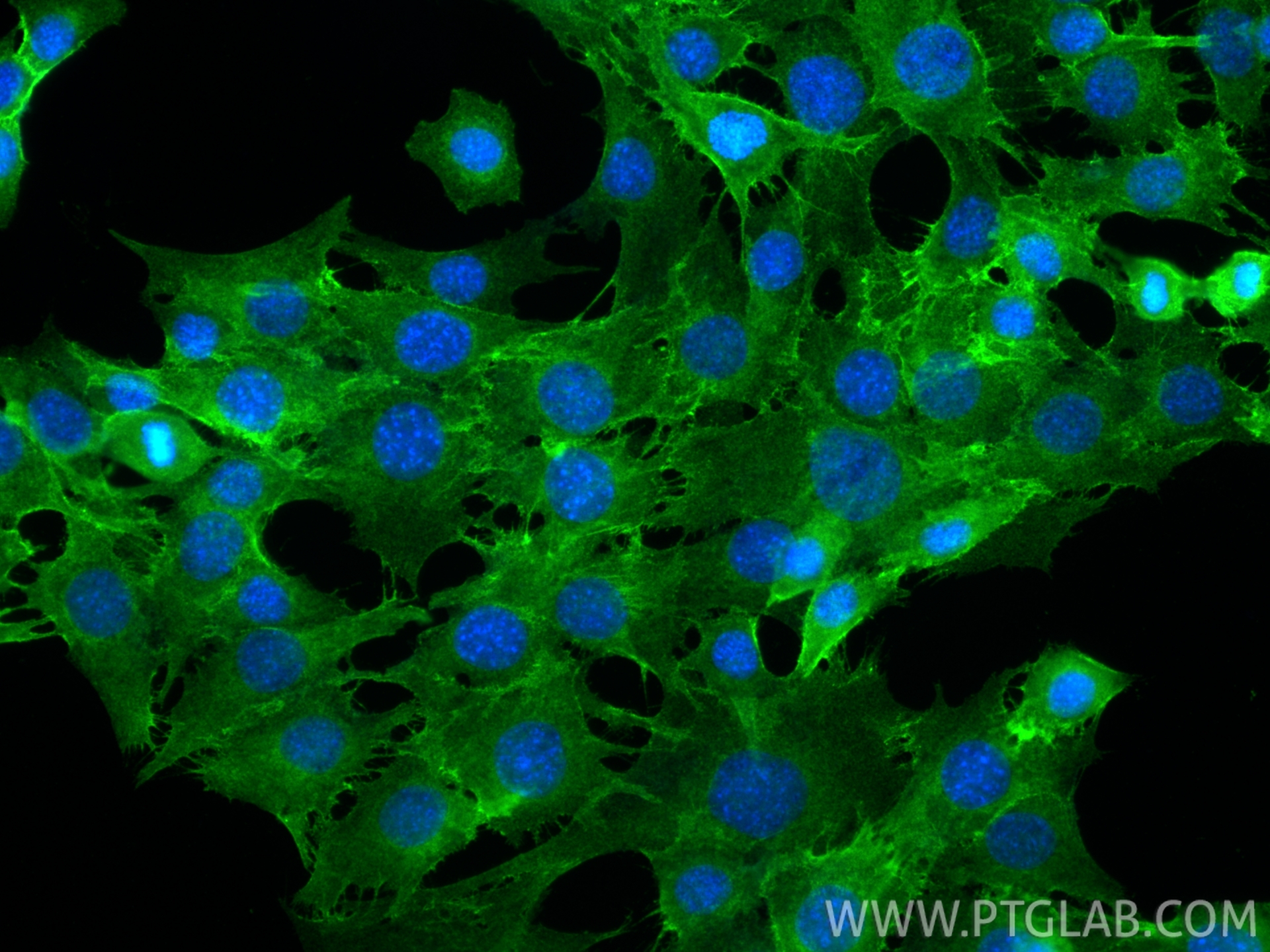 Immunofluorescence (IF) / fluorescent staining of C2C12 cells using N-cadherin Polyclonal antibody (22018-1-AP)