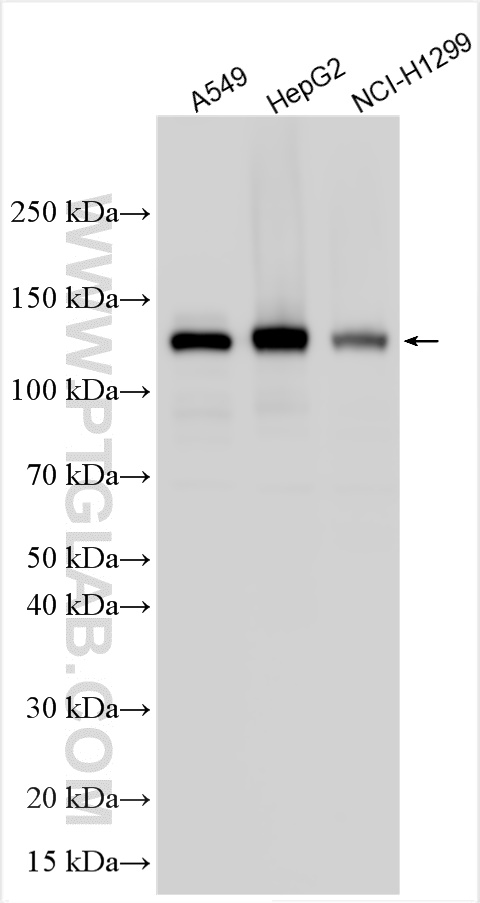 Western Blot (WB) analysis of various lysates using N-cadherin Polyclonal antibody (22018-1-AP)