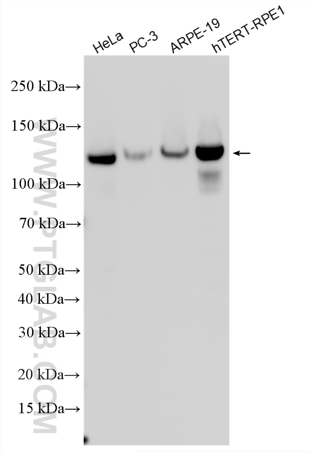 Western Blot (WB) analysis of various lysates using N-cadherin Polyclonal antibody (22018-1-AP)