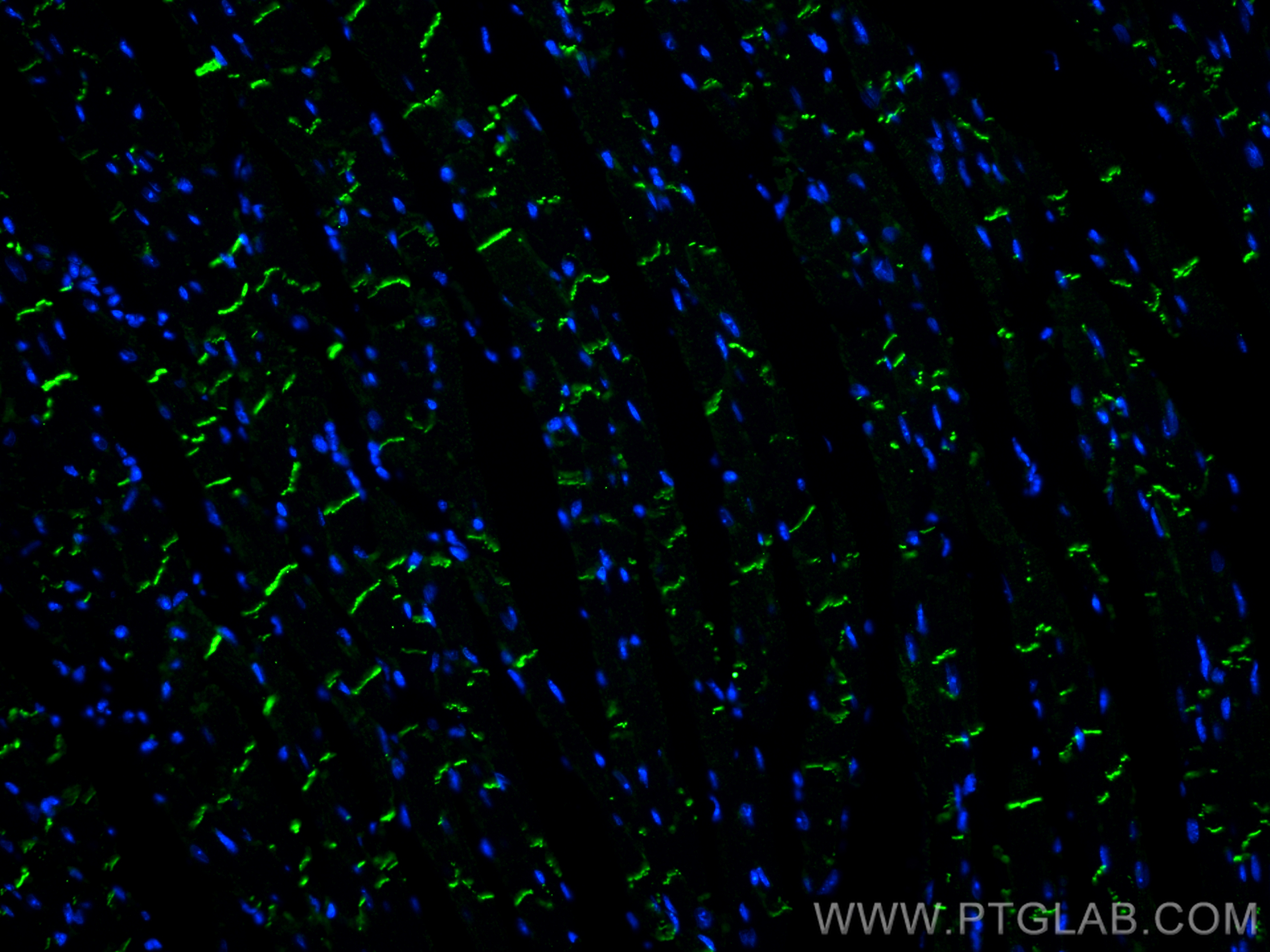 Immunofluorescence (IF) / fluorescent staining of mouse heart tissue using N-cadherin Monoclonal antibody (66219-1-Ig)