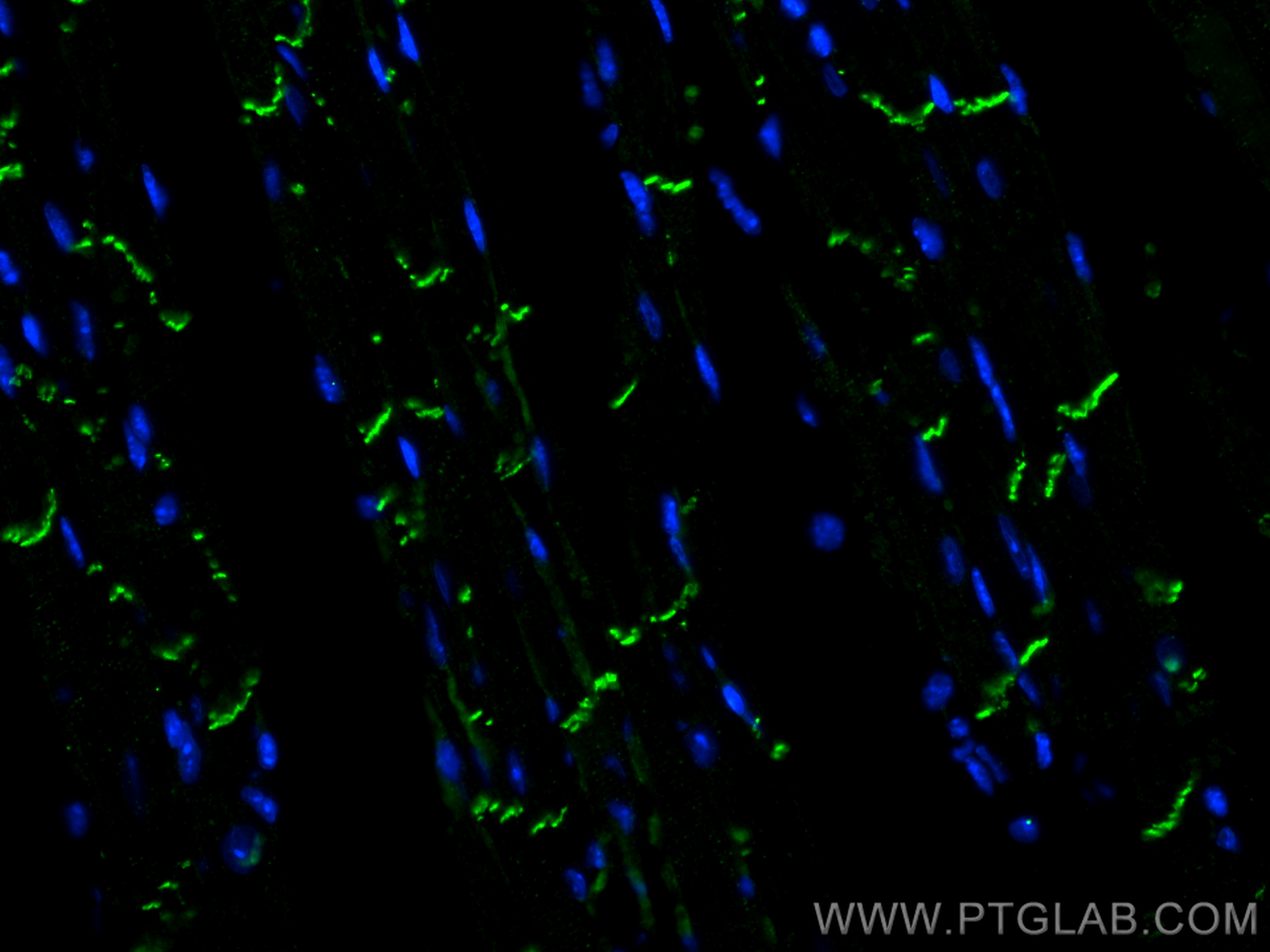 Immunofluorescence (IF) / fluorescent staining of mouse heart tissue using N-cadherin Monoclonal antibody (66219-1-Ig)