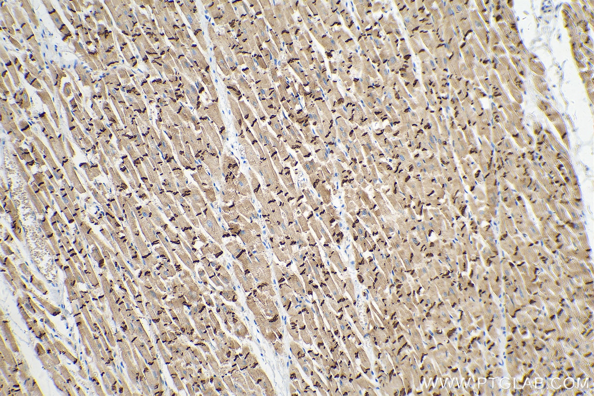 Immunohistochemistry (IHC) staining of human heart tissue using N-cadherin Monoclonal antibody (66219-1-Ig)