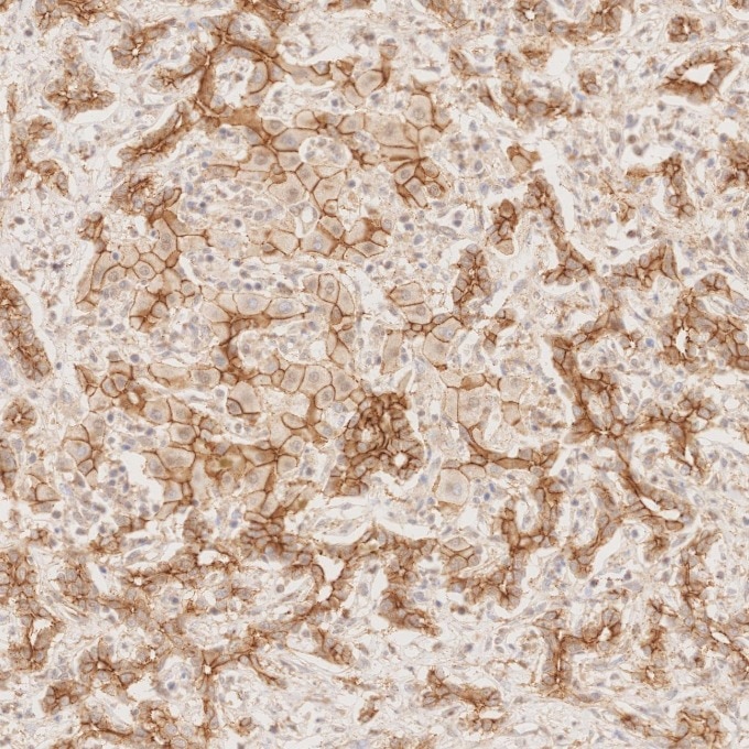 Immunohistochemistry (IHC) staining of human liver tissue using N-cadherin Monoclonal antibody (66219-1-Ig)