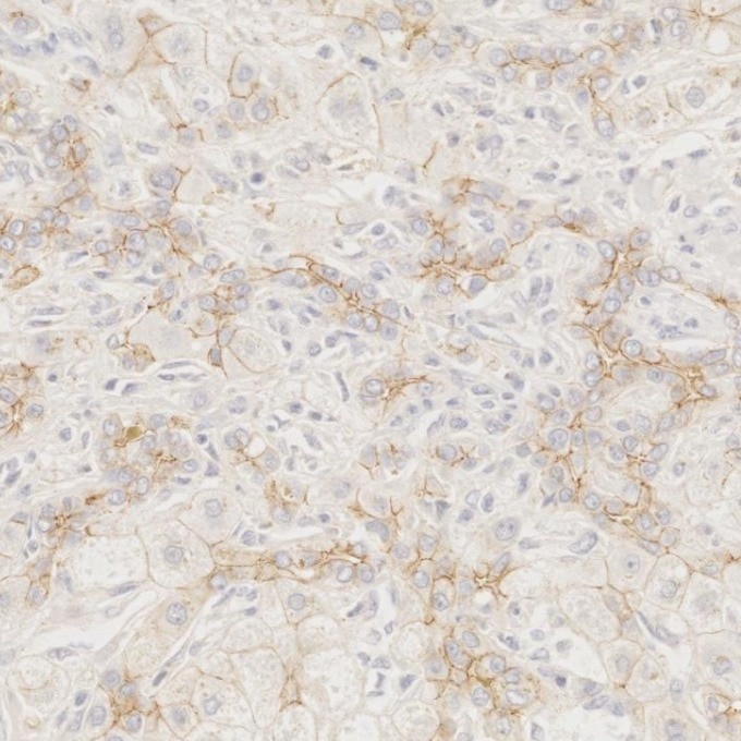 Immunohistochemistry (IHC) staining of human liver tissue using N-cadherin Monoclonal antibody (66219-1-Ig)