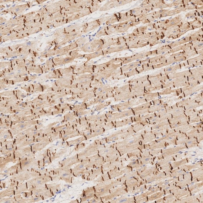 Immunohistochemistry (IHC) staining of human heart tissue using N-cadherin Monoclonal antibody (66219-1-Ig)