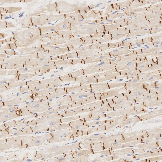 Immunohistochemistry (IHC) staining of human heart tissue using N-cadherin Monoclonal antibody (66219-1-Ig)