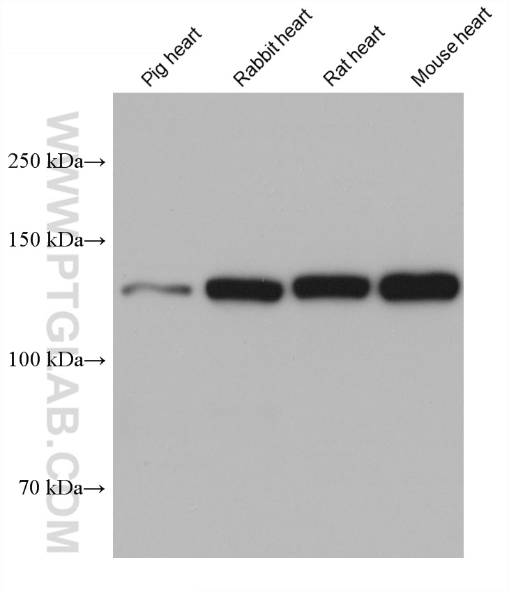 Western Blot (WB) analysis of various lysates using N-cadherin Monoclonal antibody (68532-2-Ig)