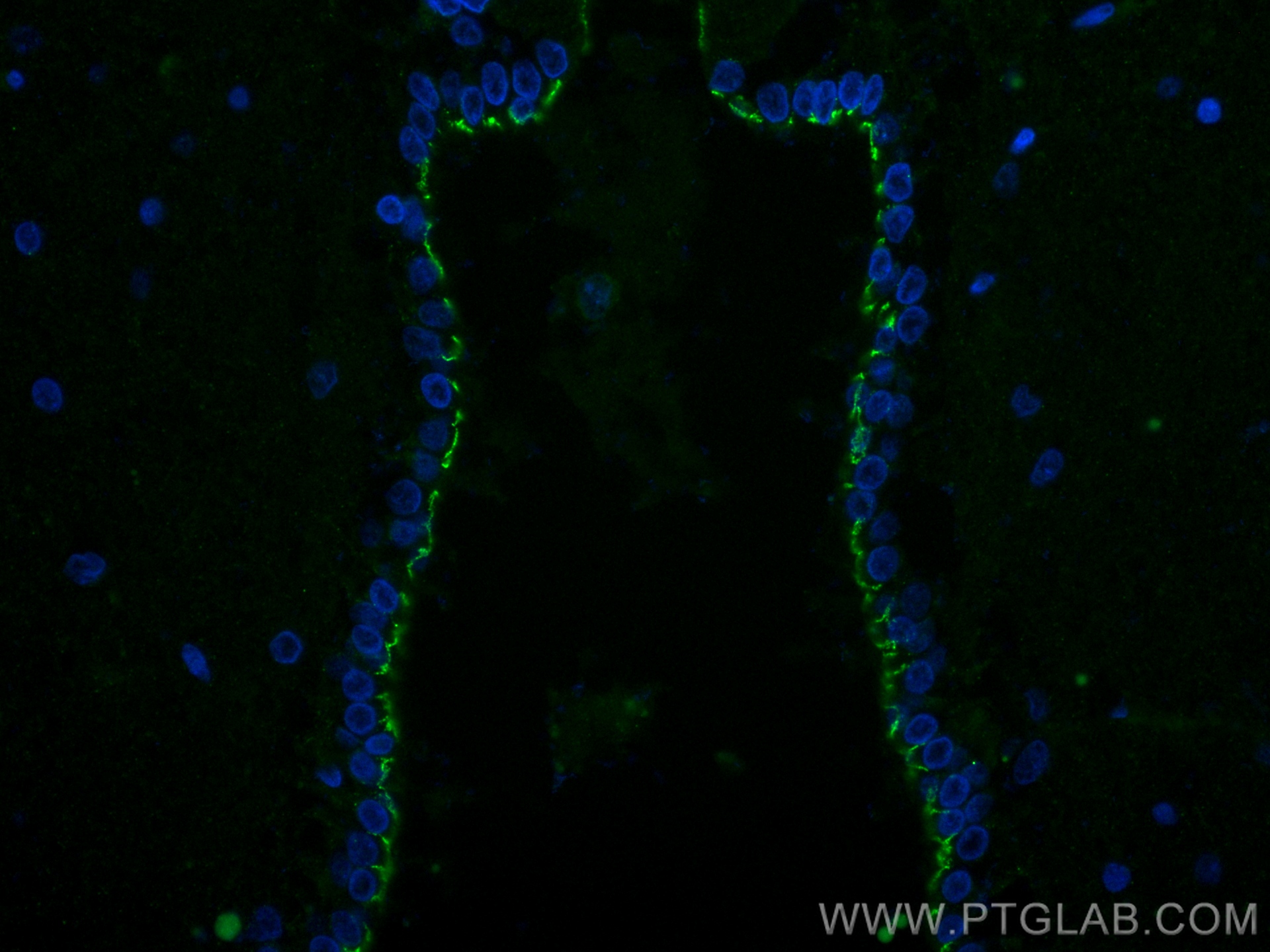 Immunofluorescence (IF) / fluorescent staining of rat brain tissue using N-cadherin Recombinant antibody (82968-1-RR)