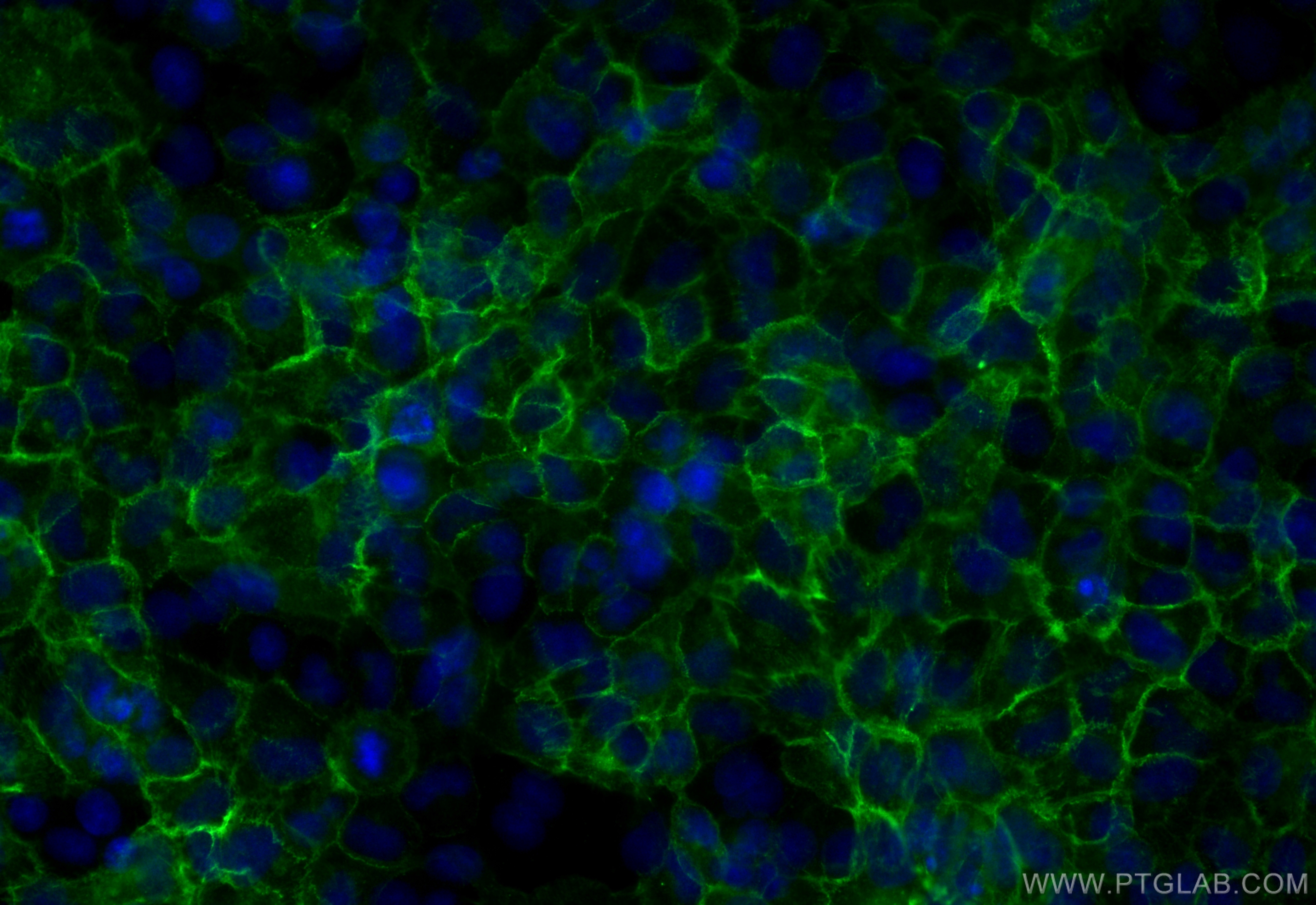 Immunofluorescence (IF) / fluorescent staining of A549 cells using N-cadherin Recombinant antibody (82968-1-RR)