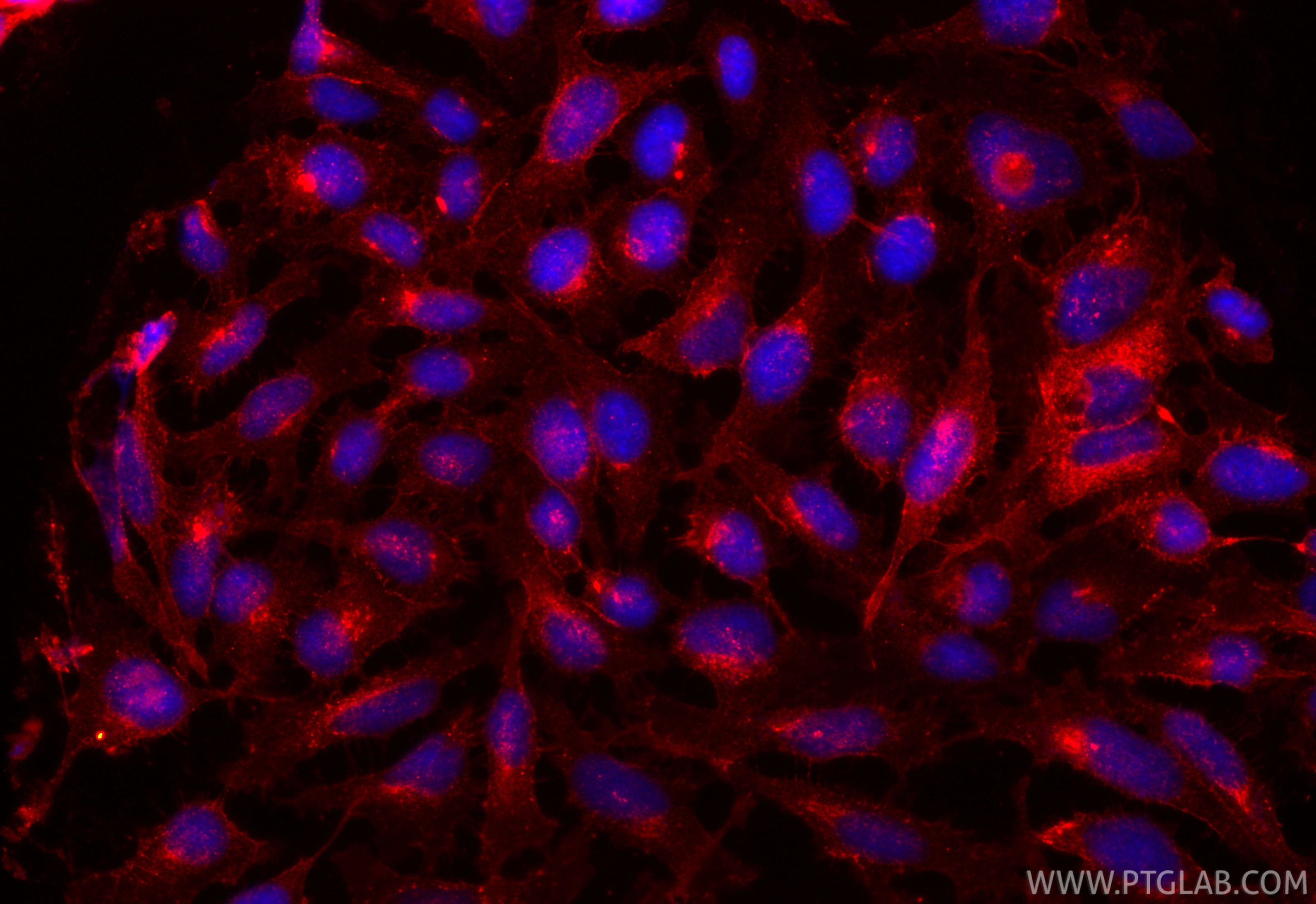 Immunofluorescence (IF) / fluorescent staining of HeLa cells using CoraLite®594-conjugated N-cadherin Recombinant ant (CL594-82968)