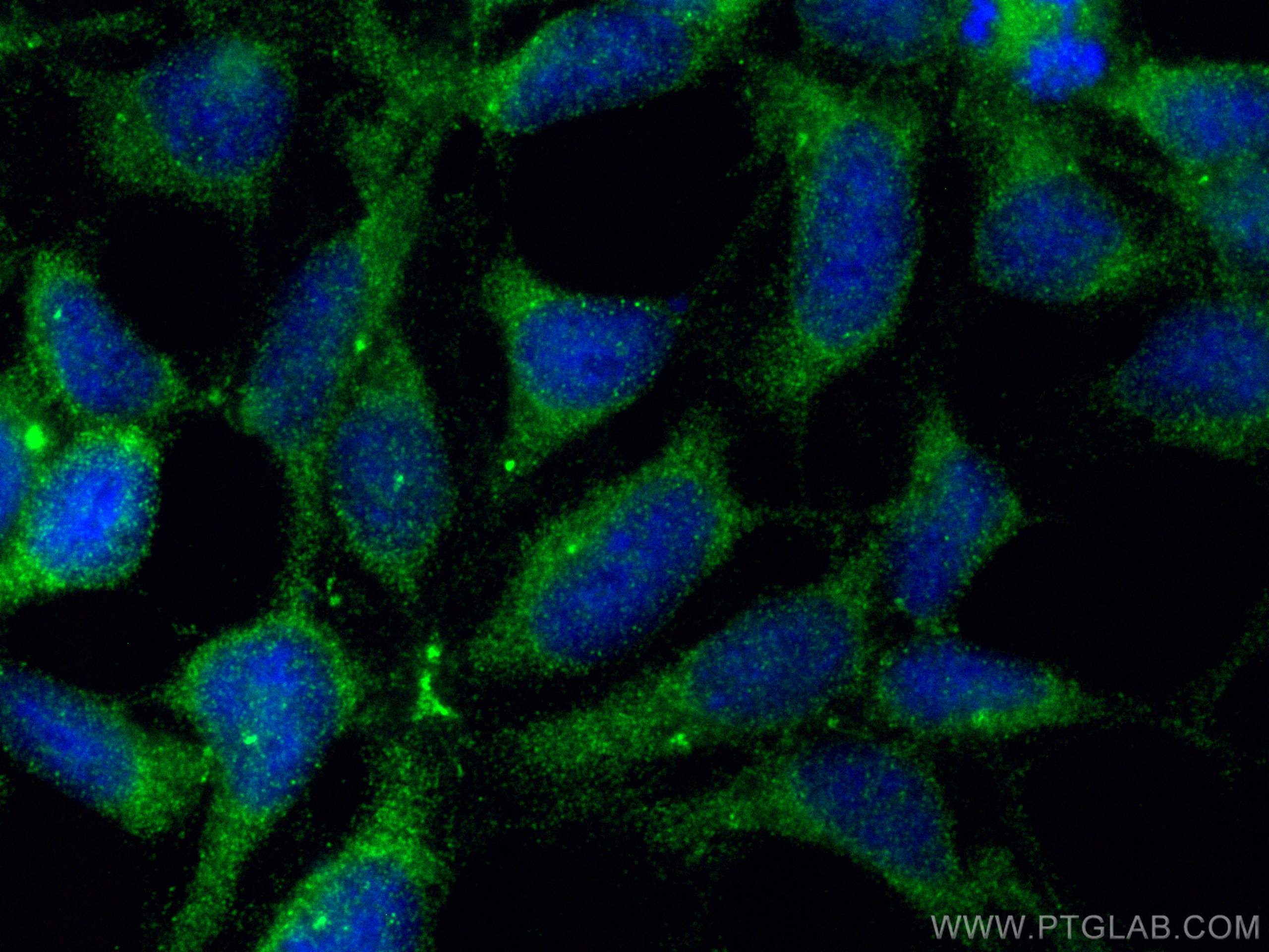 Immunofluorescence (IF) / fluorescent staining of HEK-293 cells using N4BP3 Polyclonal antibody (16733-1-AP)