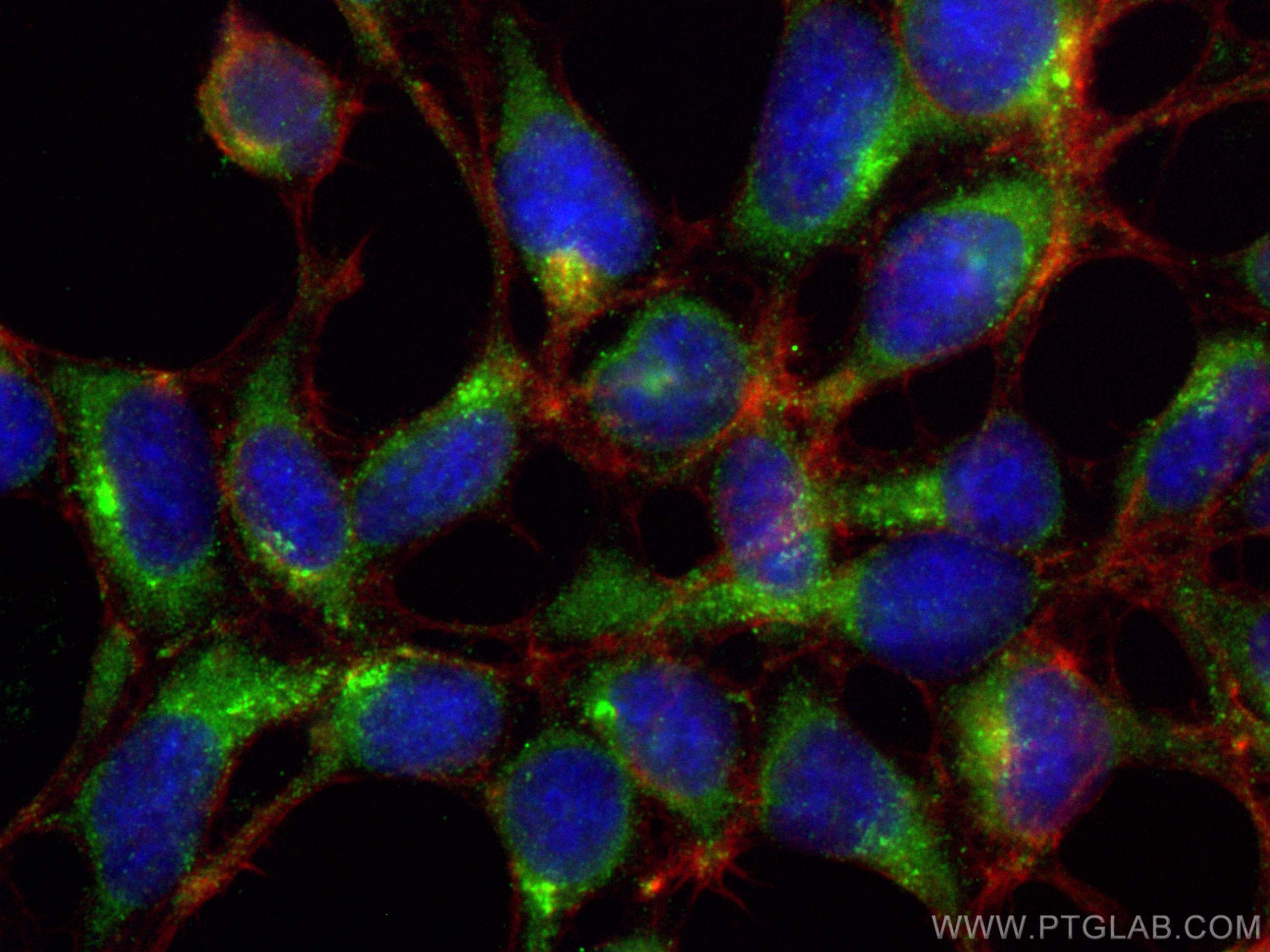 Immunofluorescence (IF) / fluorescent staining of HEK-293 cells using N4BP3 Polyclonal antibody (16733-1-AP)