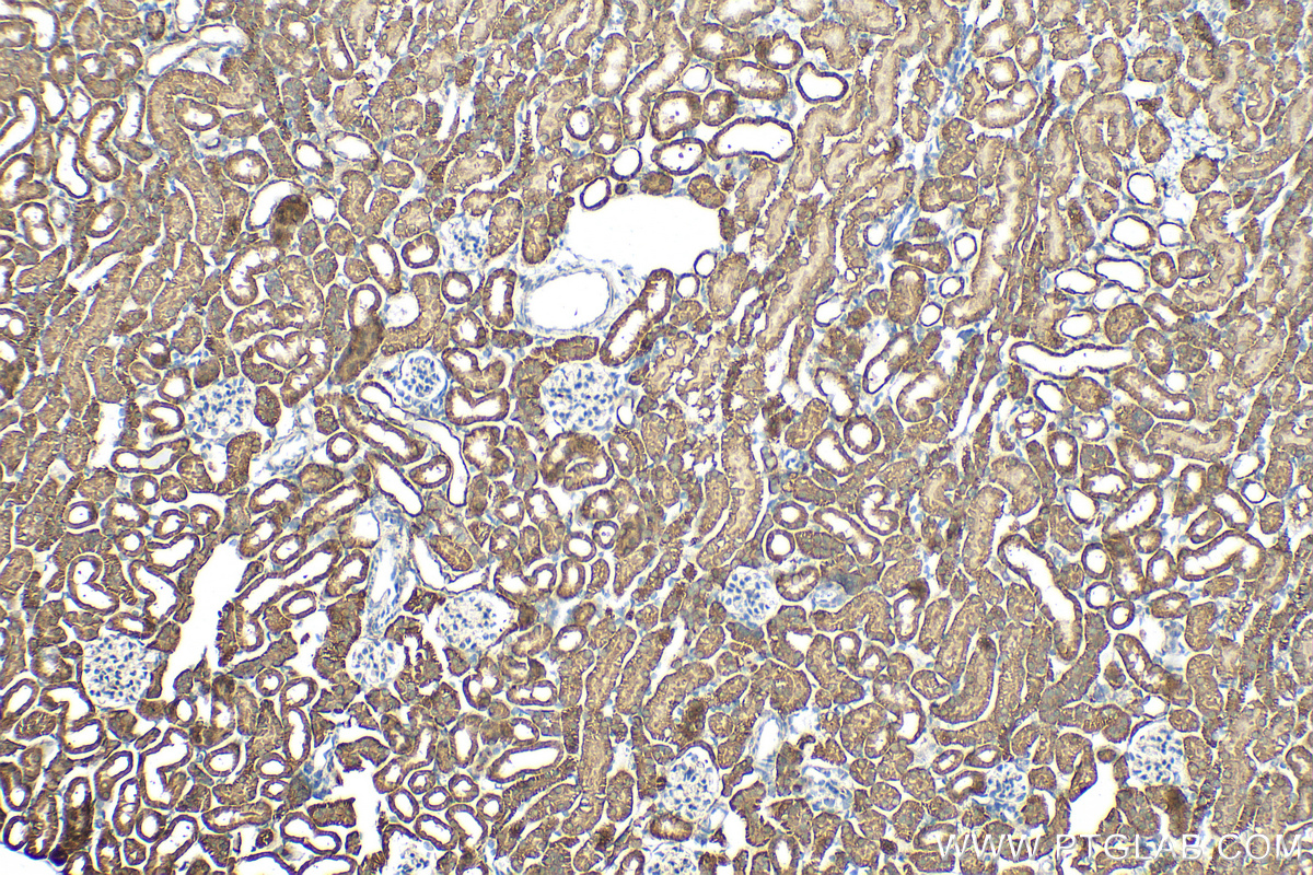 Immunohistochemistry (IHC) staining of mouse kidney tissue using N4BP3 Polyclonal antibody (16733-1-AP)