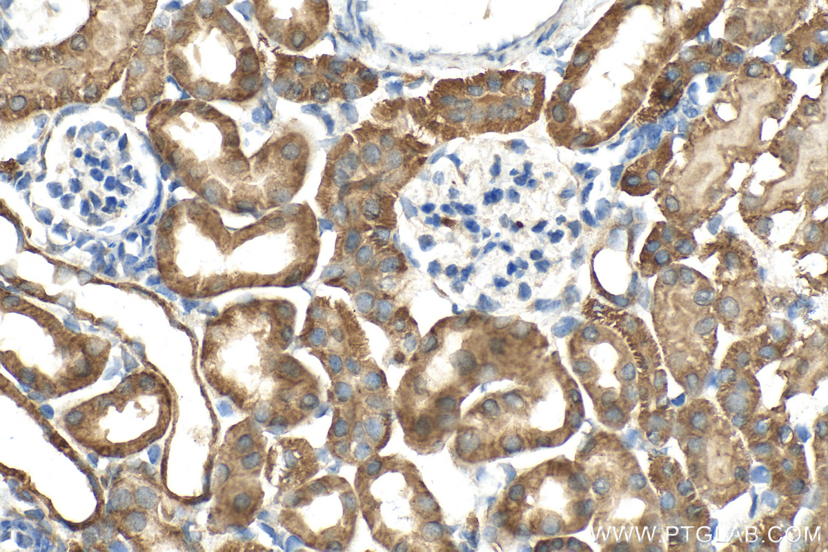 Immunohistochemistry (IHC) staining of mouse kidney tissue using N4BP3 Polyclonal antibody (16733-1-AP)