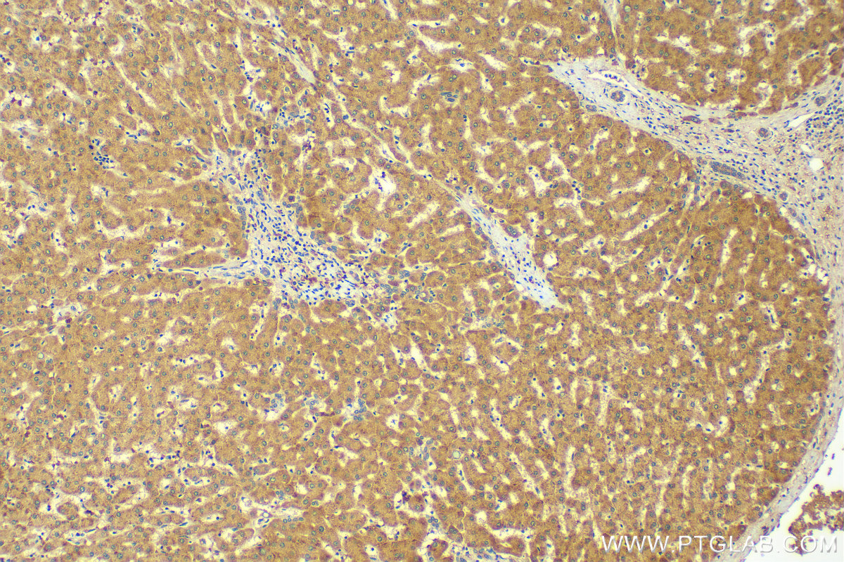 Immunohistochemistry (IHC) staining of human liver tissue using N4BP3 Recombinant antibody (83178-2-RR)