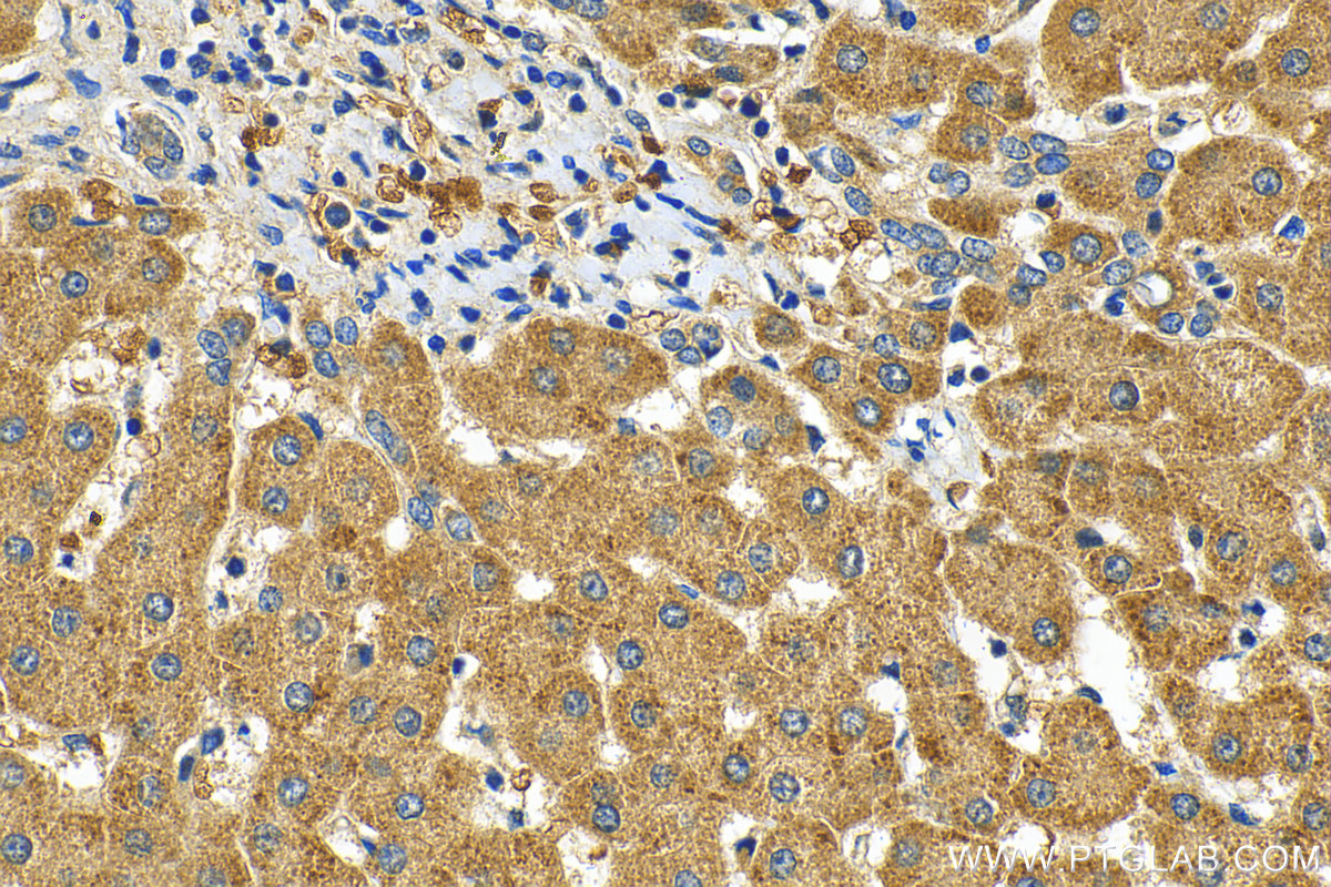 Immunohistochemistry (IHC) staining of human liver tissue using N4BP3 Recombinant antibody (83178-2-RR)